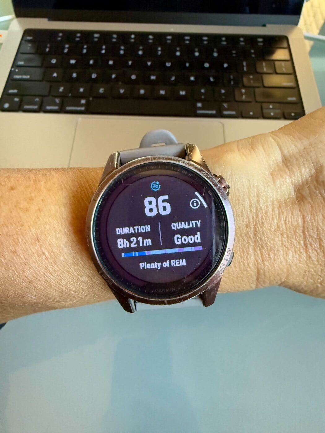 A woman's wrist showing her watch and sleep score. 